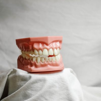 teeth-5522653_1280 teeth-5522653_1280